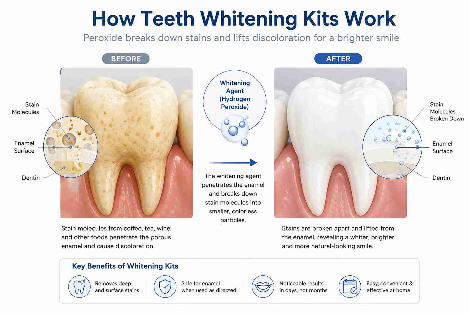Diagram showing how hydrogen peroxide removes stains from tooth enamel