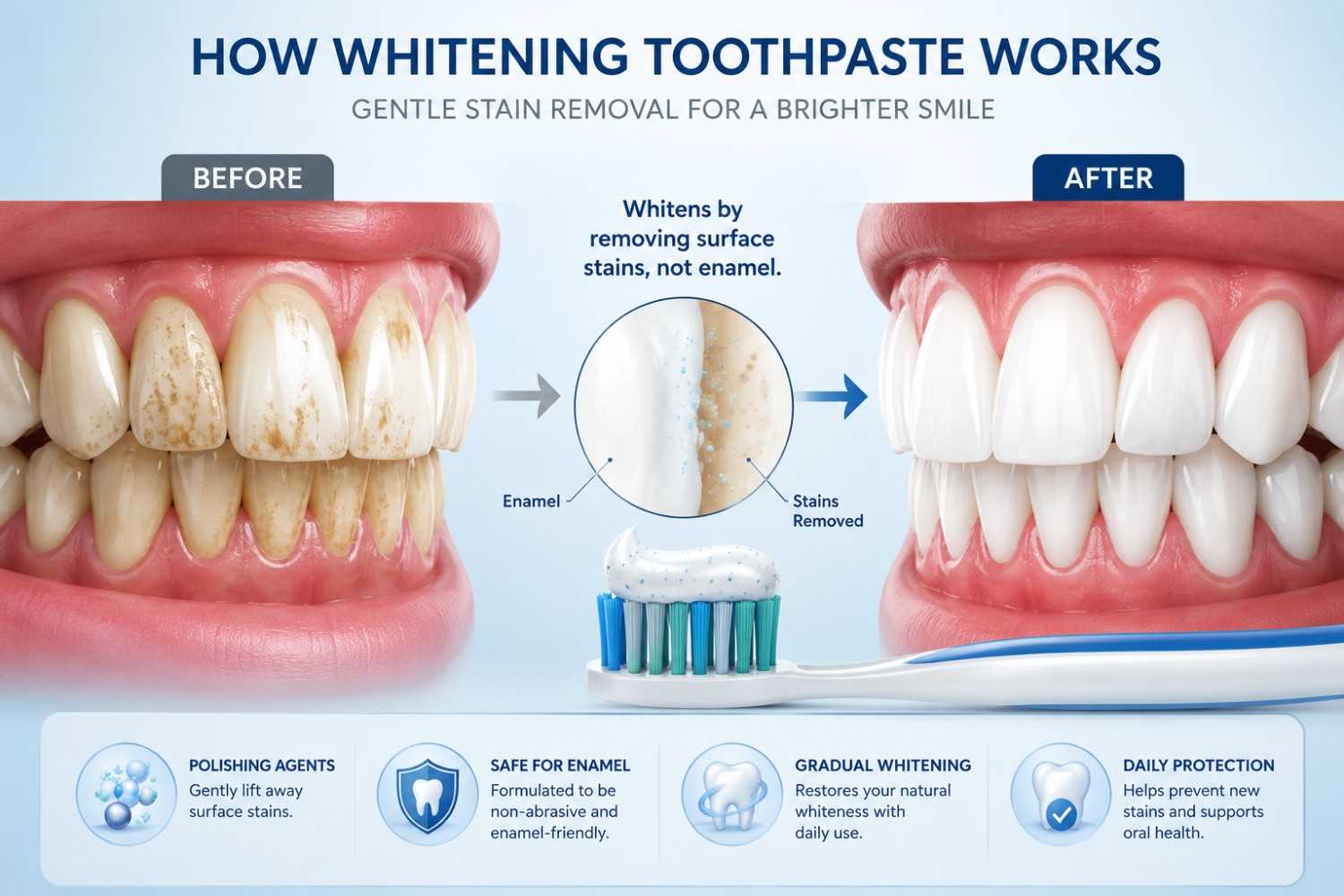 Illustration explaining how whitening toothpaste removes surface stains