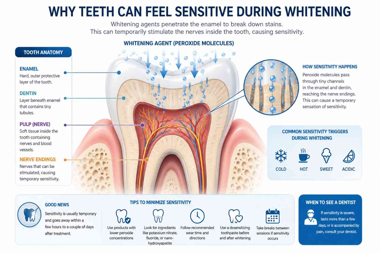 Illustration showing why whitening causes tooth sensitivity