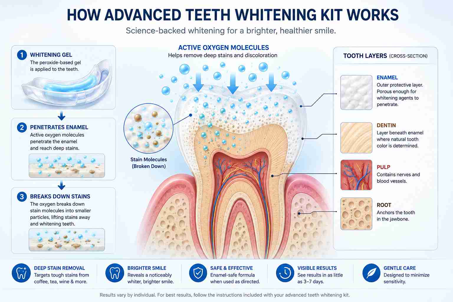 Illustration showing how an advanced teeth whitening kit removes deep stains
