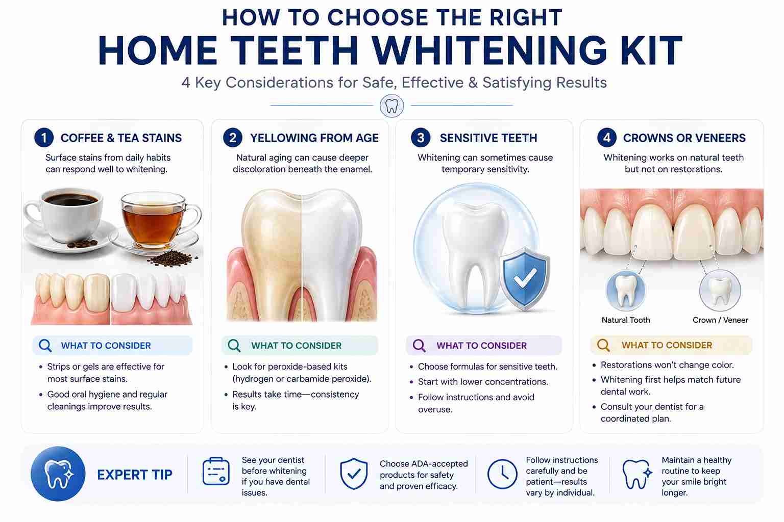 Choosing a home teeth whitening kit based on stains sensitivity and dental restorations