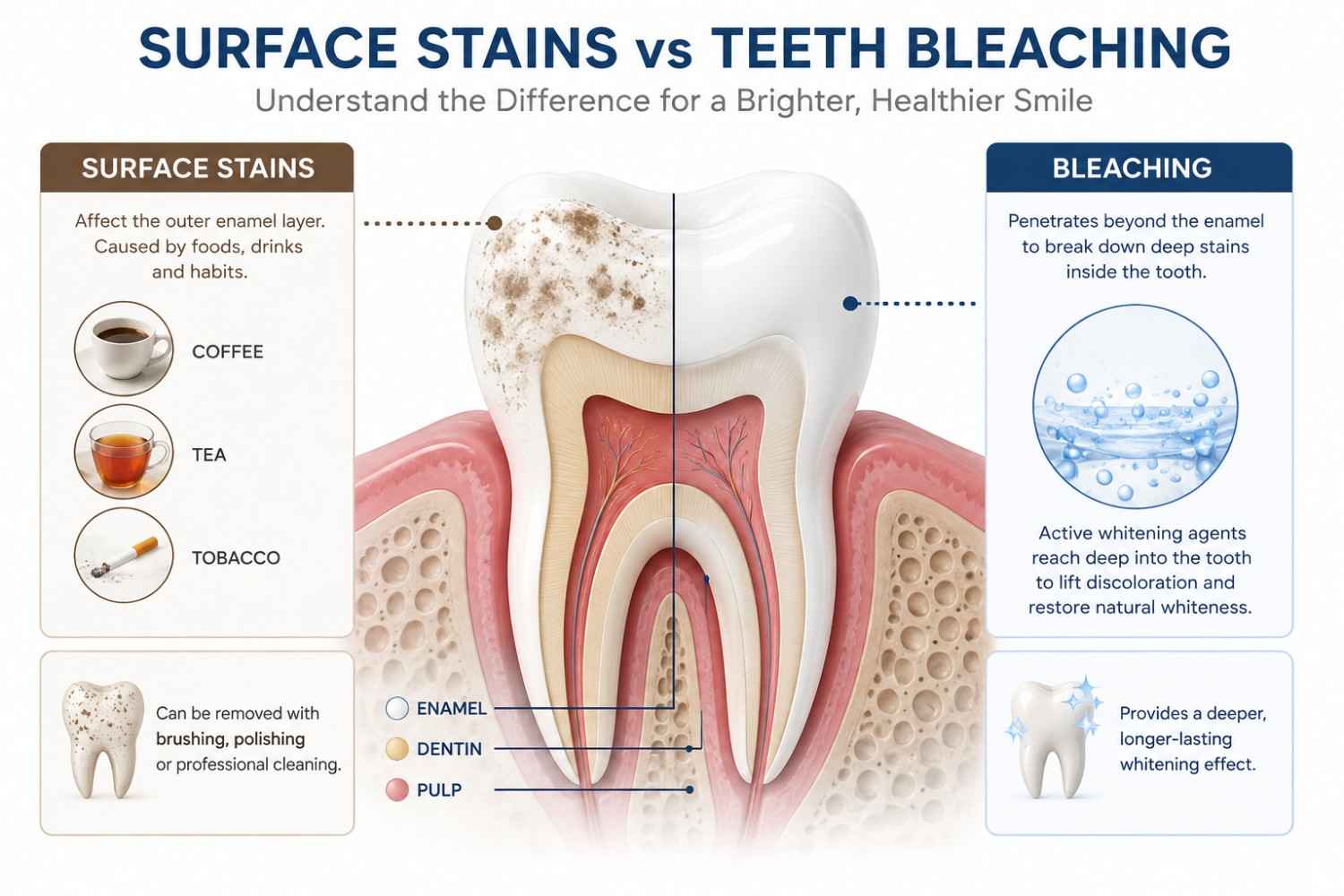 surface tooth stains compared with teeth whitening